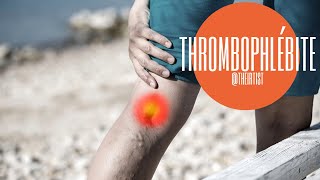 Comment traiter les thrombophlébites et caillots des veines par radiologie interventionnelle [upl. by Yendahc]