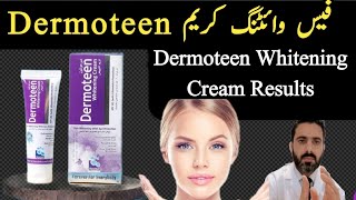 Dermoteen Whitening Cream Review Hand and Foot Whitening cream In Pakistan [upl. by Oiramej159]