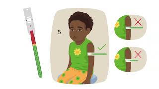 How to Identify Malnutrition in Children [upl. by Cullin]