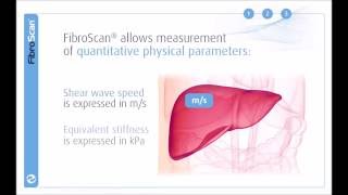 3 Stages of the FibroScan examination [upl. by Venditti]