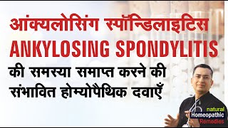 Ankylosing Spondylitis  Natural Homeopathic remedies with symptoms  होम्योपैथिक उपचार [upl. by Milstone]