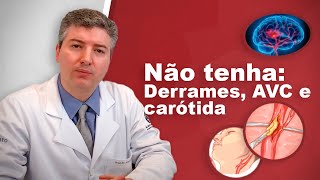 Dr Alexandre Amato Revela os Segredos da Prevenção de Derrames [upl. by Llenreb]