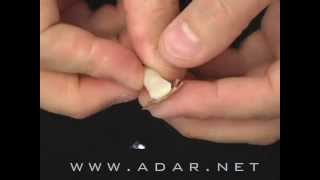 How to Master Porcelain Laminate Veneers with Platinum Foil Technique [upl. by Ahsitel409]