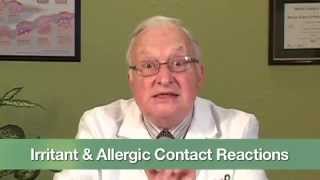 Irritant amp Allergic Contact Reactions [upl. by Radnaskela]