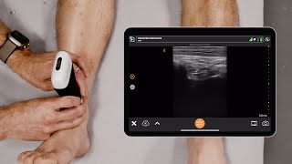 Ultrasound of the Ankle [upl. by Budd669]