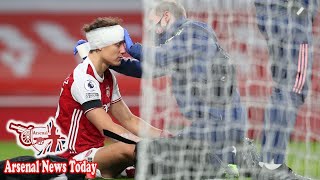 David Luiz and Raul Jimenez in sickening clash of heads during Arsenal vs Wolves clash  news today [upl. by Eceeryt160]