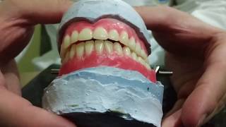 Enfilado de dientes artificiales en prótesis total 22 [upl. by Jempty]