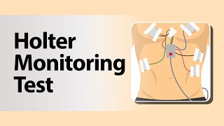 Holter Monitoring Test [upl. by Downing]