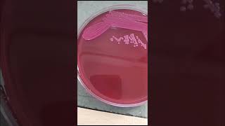 Klebsiella pneumonia grow in macConkey agar for blood cs  Microbiologist  bacterilogh microb mp [upl. by Geller772]