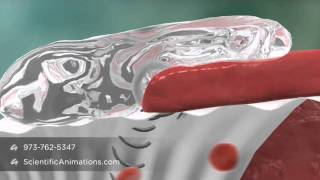 Coseal Resorption  MOA Animation [upl. by Aset]