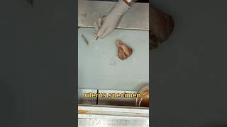 Uterus specimen cutting 🧐✂️ [upl. by Skillern]