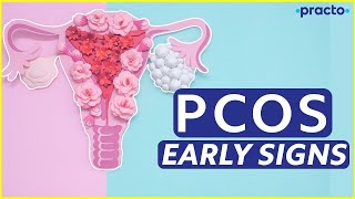 What Is PCOS  What Are The Symptoms Of PCOS  PCOS Treatment In Hindi  Practo [upl. by Selegna]