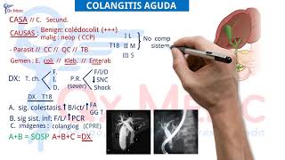 Ficha resumen Cirugía general Colangitis aguda ENAMENARMSERUMS [upl. by Aitetel375]