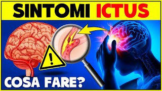 Segnali Precoci dellIctus Non Ignorare Questi Sintomi Cosa Fare In Caso Di Ictus [upl. by Clim]