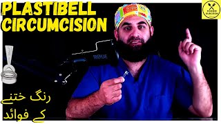 Plastibell Circumcision  Benefits [upl. by Heinrick]