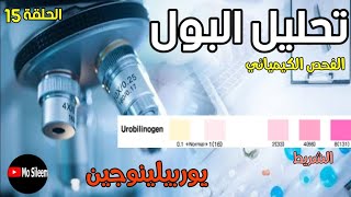 Urinalysis 15 chemical ex Urobilinogen dipstick [upl. by Anastatius]