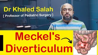 Meckels diverticulum medical students and pediatric surgeons [upl. by Adriene]