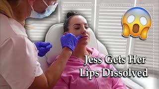 I Had My Lip Filler DISSOLVED [upl. by Ynot841]