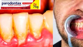 Parodontax Toothpaste  GSK  Plaque  Bad Breath  Gums Problem  Sodium Bicarbonate [upl. by Ethelind]