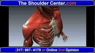 Shoulder Pain  All You Need to Know About BursitisTendonitisImpingement SyndromeFrozen Shoulder [upl. by Stoeber]