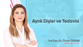 Ayrık Dişler ve Tedavisi [upl. by Jarrid]