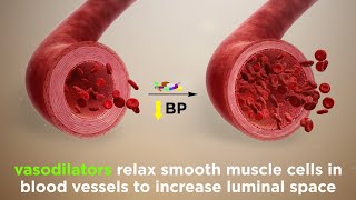 Vasodilators Treating Hypertension [upl. by Jannel]