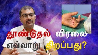 What is the treatment of choice for trigger finger Dr Soundar I Tamil [upl. by Enylodnewg]