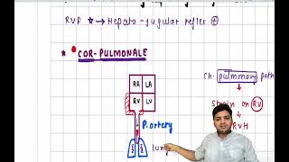 Cor Pulmonale 101 What You Need to Know [upl. by Narrat514]