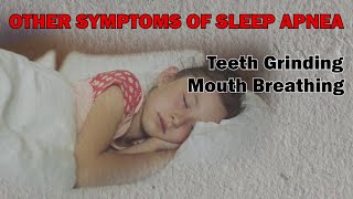 What are the signs of sleep apnea in children [upl. by Kcirdderf]