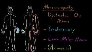 Syndrome Mononeuropathy [upl. by Olwen]