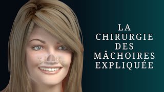 La chirurgie des mâchoires expliquée [upl. by Ibocaj]