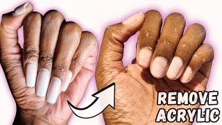 How to REMOVE ACRYLIC NAILS AT HOME  TAKE OFF ACRYLIC NAILS with ACETONE [upl. by Aehcsrop488]