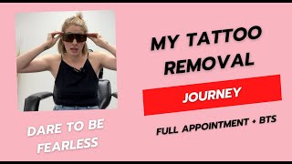 Watch Me Get My Tattoos Removed Tattoo Removal Day 1 [upl. by Cormick219]