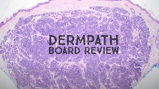 Dermatology amp Pathology Board Review Hyaluronic Acid Filler Trichoblastoma Blue Nevus amp more [upl. by Scornik]