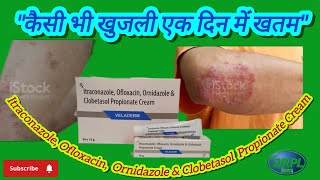 🔥Itraconazole Ofloxacin Ornidazole amp Clobetasol Propionate Cream। दादखाज और खुजली एक में खतम 100 [upl. by Nnairac966]