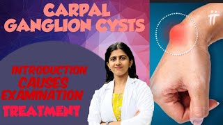 GANGLION CYSTS TREATMENT  INTRODUCTION  PART 1  IN HINDI [upl. by Herrod]