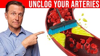 The 1 Best Remedy to Clean Plaque From Your Arteries [upl. by Cohlier]