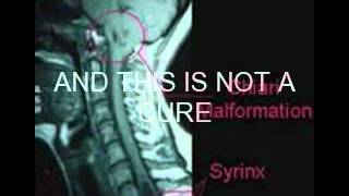 Chiari awareness video [upl. by Kearney]