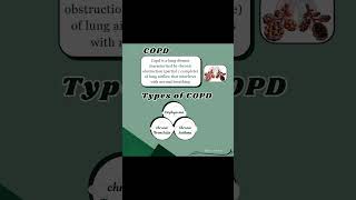 COPD  Types and Difference between bronchitis vs emphysema lovemedics [upl. by Enomyar]