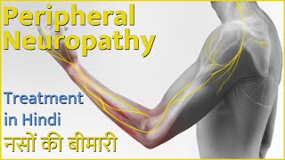 PERIPHERAL NEUROPATHIC PAIN IN HINDI what is peripheral neuropathy what can be done about it [upl. by Pearse562]