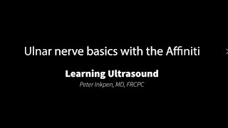 Ulnar Nerve Ultrasound Basics [upl. by Ylnevaeh]