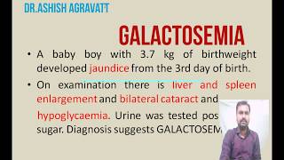 Galactosemia  Galactose metabolism  Biochemistry [upl. by Eniluap303]