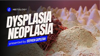 HISTOLOGY  Dysplasia amp Neoplasia [upl. by Palila]