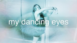 My Dancing Eyes  Nystagmus [upl. by Maite337]