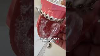 🦷 Water Flosser for Teeth 💧 4 Jet Tips for Home amp Travel 🛫 [upl. by Hege117]