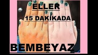 15 DAKİKADA GÜNEŞ LEKESİ  YAŞLILIK LEKESİ GİDERİCİ BEYAZLATICI  DOĞAL EL BAKIMI  Güzellik Bakım [upl. by Lia]