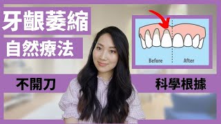 【Eng subs】牙齦萎縮 Gum Recession Natural Remedies 這些自然療法真的有科學根據！油拔法怎麼進行？｜Dr Grace [upl. by Frida]