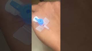 IV cannula insertiondocternursingtrendingforyouyoutubelovepopularviralvideoshortvideo [upl. by Leiram682]