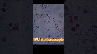 Así se ve una muestra de orina cuando hay INFECCIÓN laboratorioclinico uroanalisis short [upl. by Akeber339]