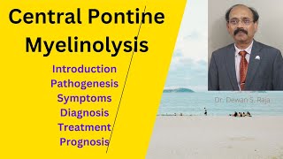 Central Pontine Myelinolysis [upl. by Denyse]